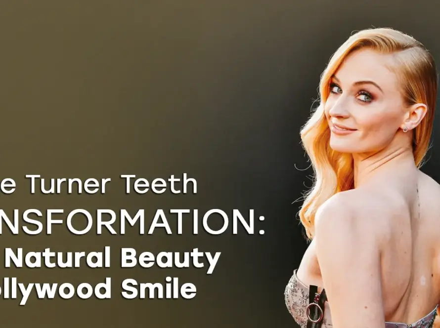 Sophie Turner Teeth