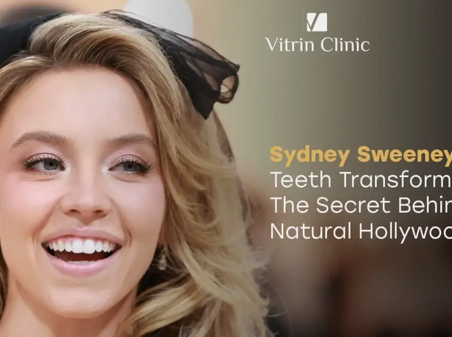 Sydney Sweeney Teeth: 5 Secrets to Her Stunning Smile