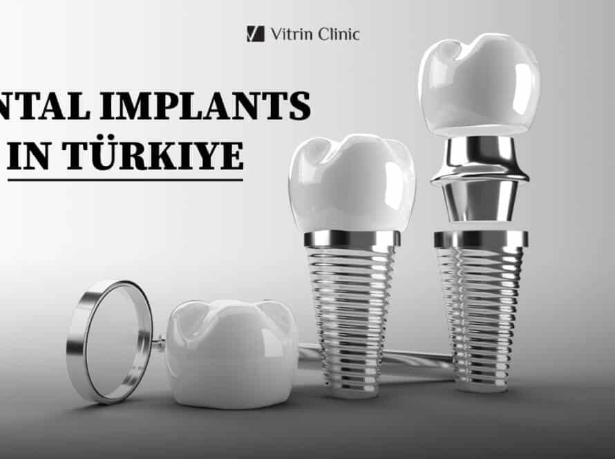 Dental Implants in Türkiye
