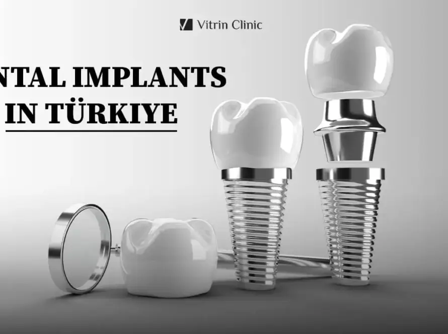 Implantes Dentales en Turquía