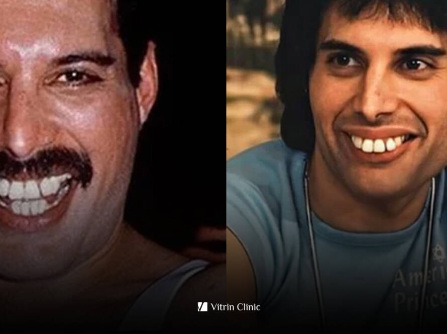 Freddie Mercury