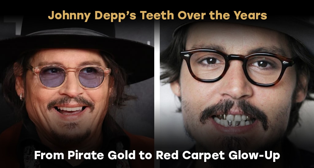 Johnny Depp's Teeth Over the Years
