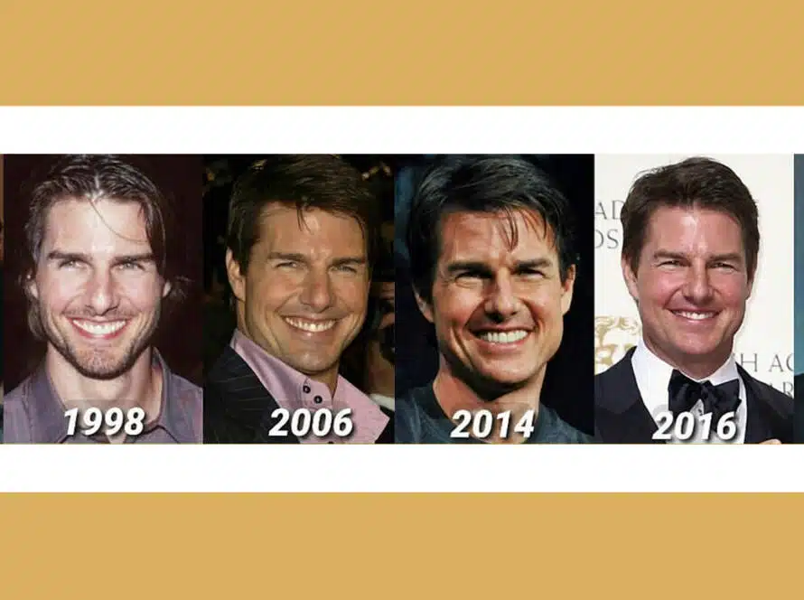 Tom Cruise Teeth