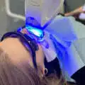 Blanchiment des dents Zoom : à quel point votre sourire peut-il devenir plus blanc en 1 heure ?