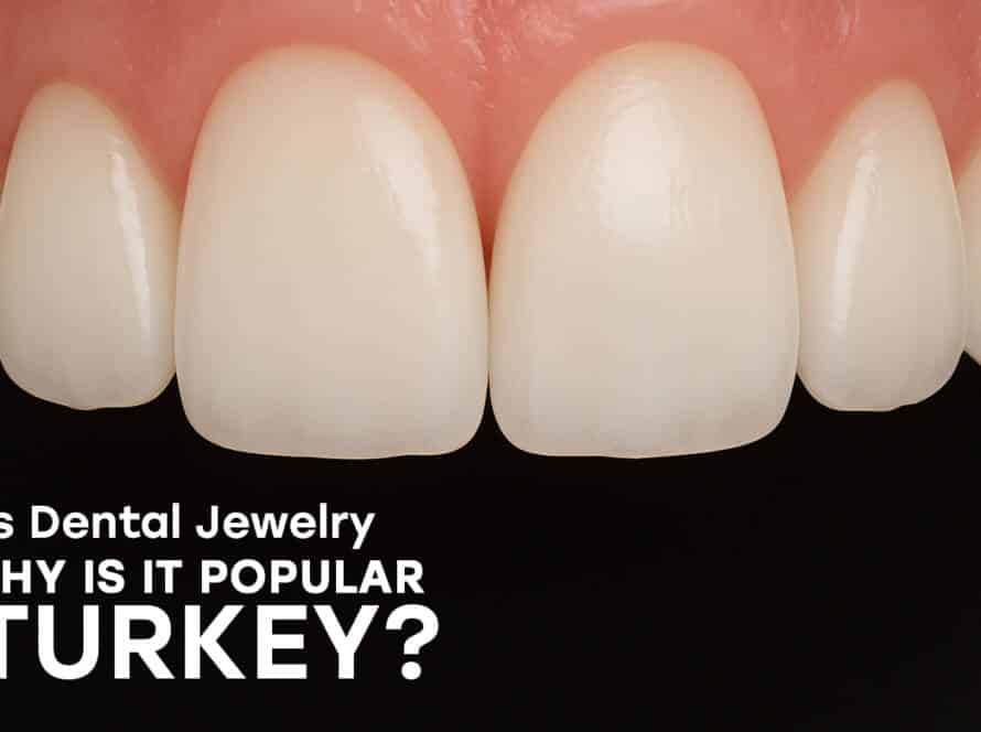 Dental jewelry