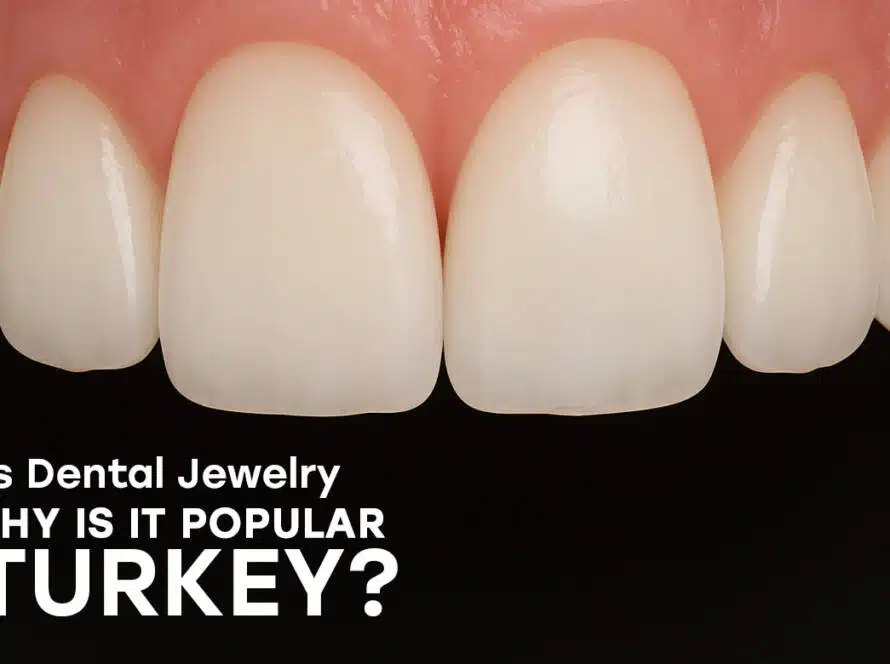 Dental jewelry