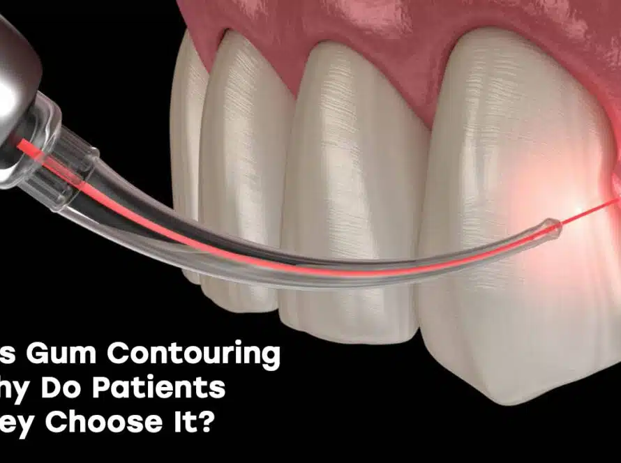 Gum contouring