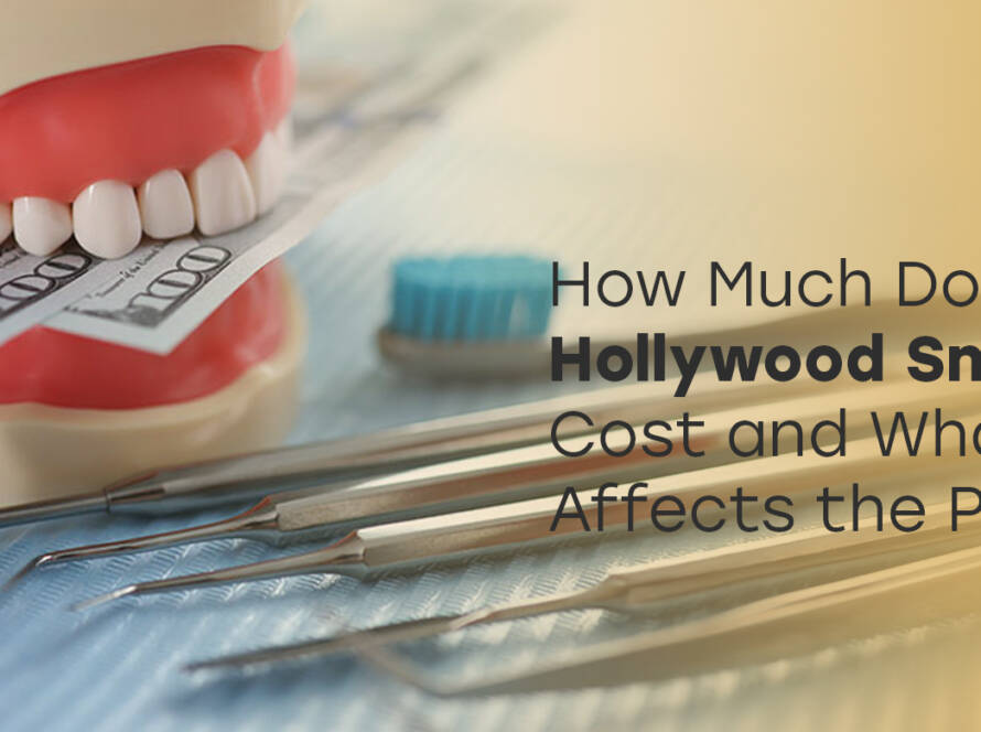 Hollywood Smile Cost