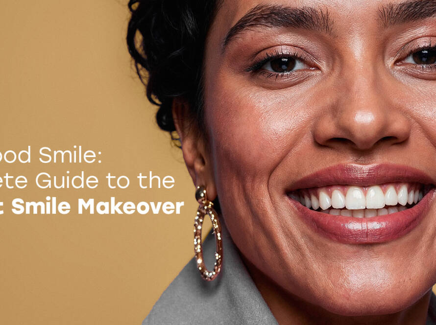 Hollywood smile
