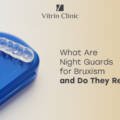 What Are Night Guards for Bruxism and Why Are They Important?