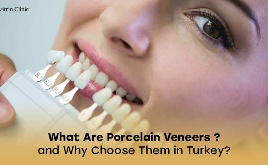 -Porcelain veneers