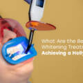 What Are the Best 10 Teeth Whitening Treatments for Achieving a Hollywood Smile?