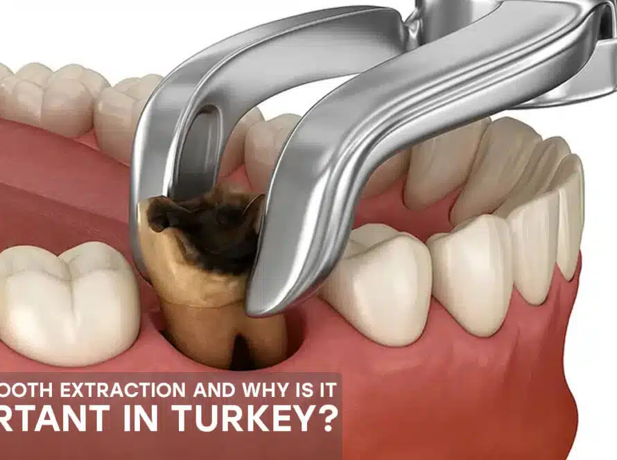 Tooth extraction