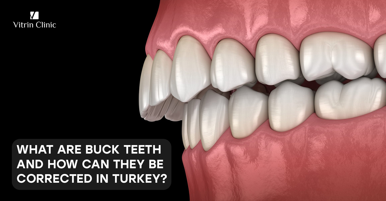 buck teeth