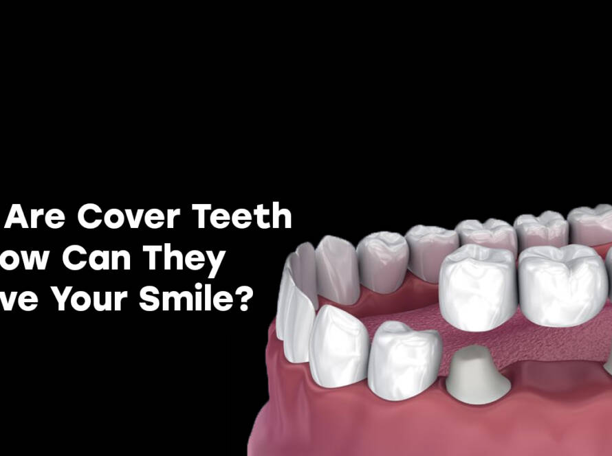 cover teeth