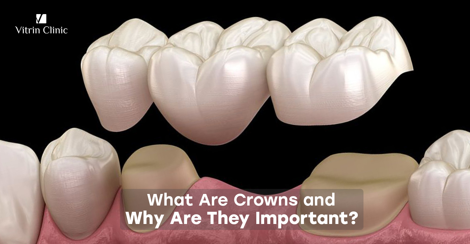 crowns