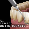 5 Powerful Reasons Why Dental Scaling Is Essential for a Healthier Smile in 2025?