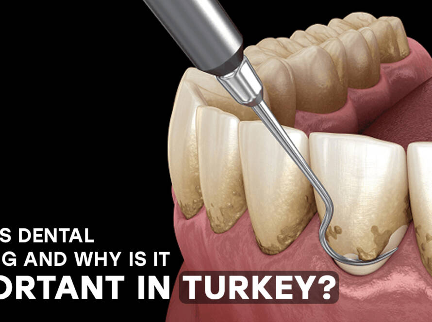 dental scaling