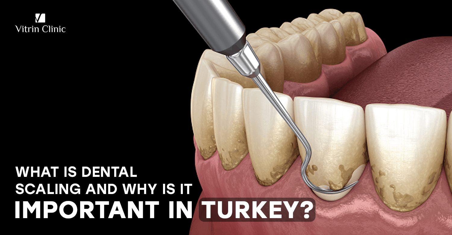 dental scaling