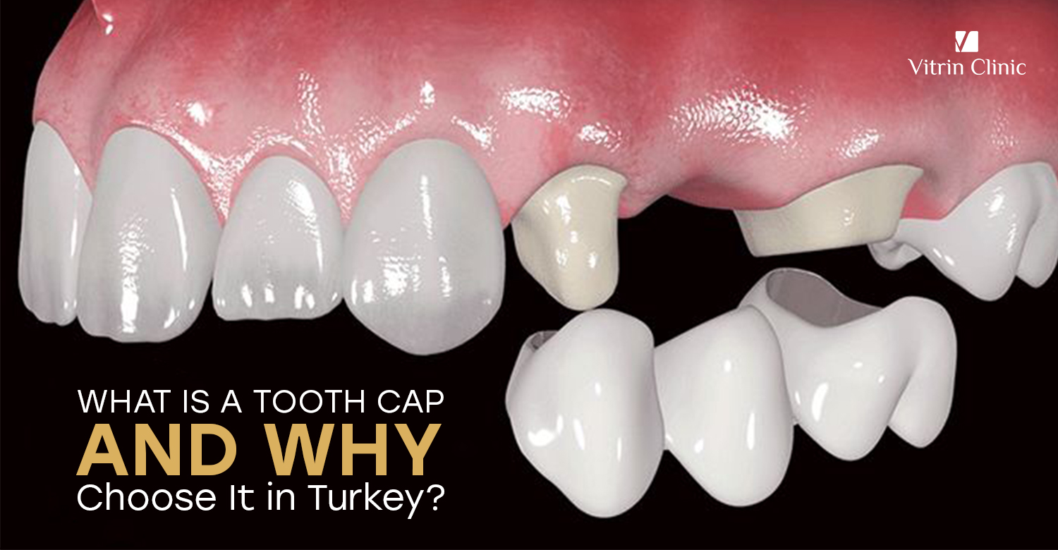 tooth cap