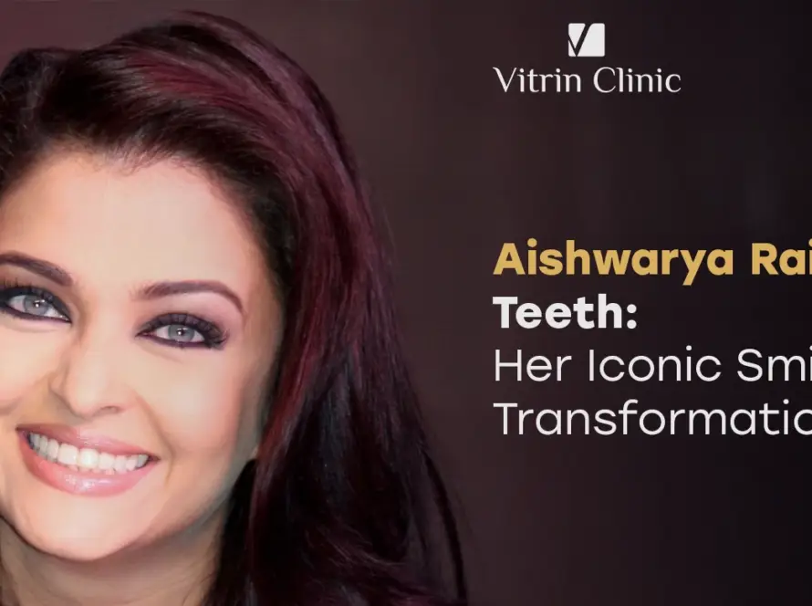 Aishwarya Rai Teeth Before and After: Her Iconic Smile Transformation 2026