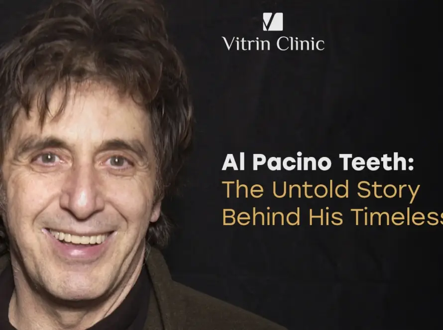 Al Pacino Teeth: The Untold Story Behind His Timeless Smile