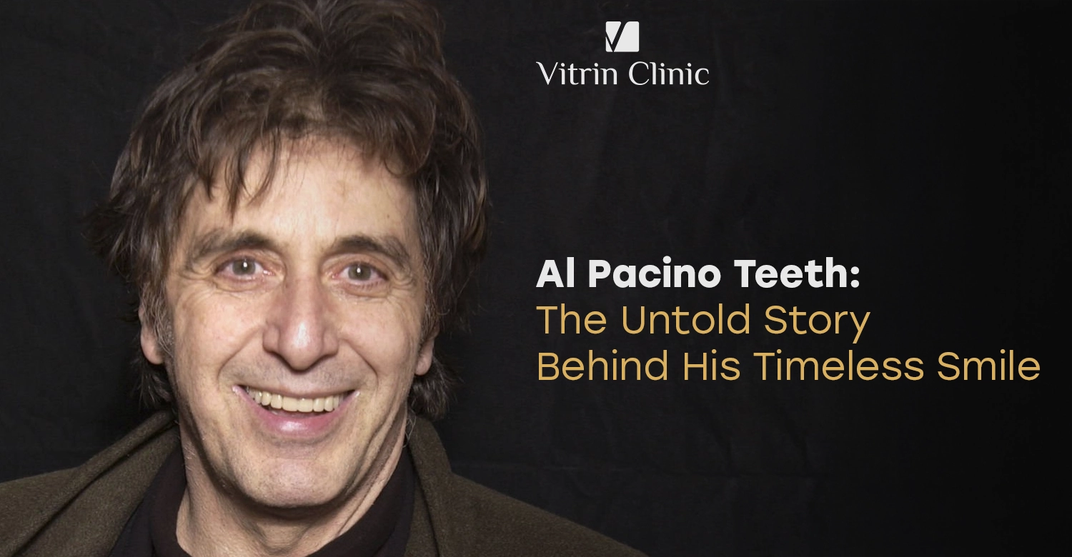 Al Pacino Teeth: The Untold Story Behind His Timeless Smile
