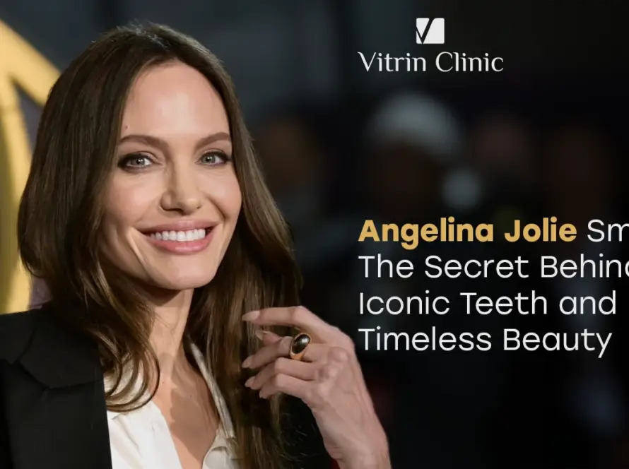 Angelina Jolie Smile: The Secret Behind Her Iconic Teeth and Timeless Beauty