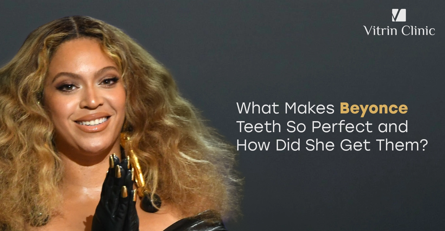 Beyonce Teeth