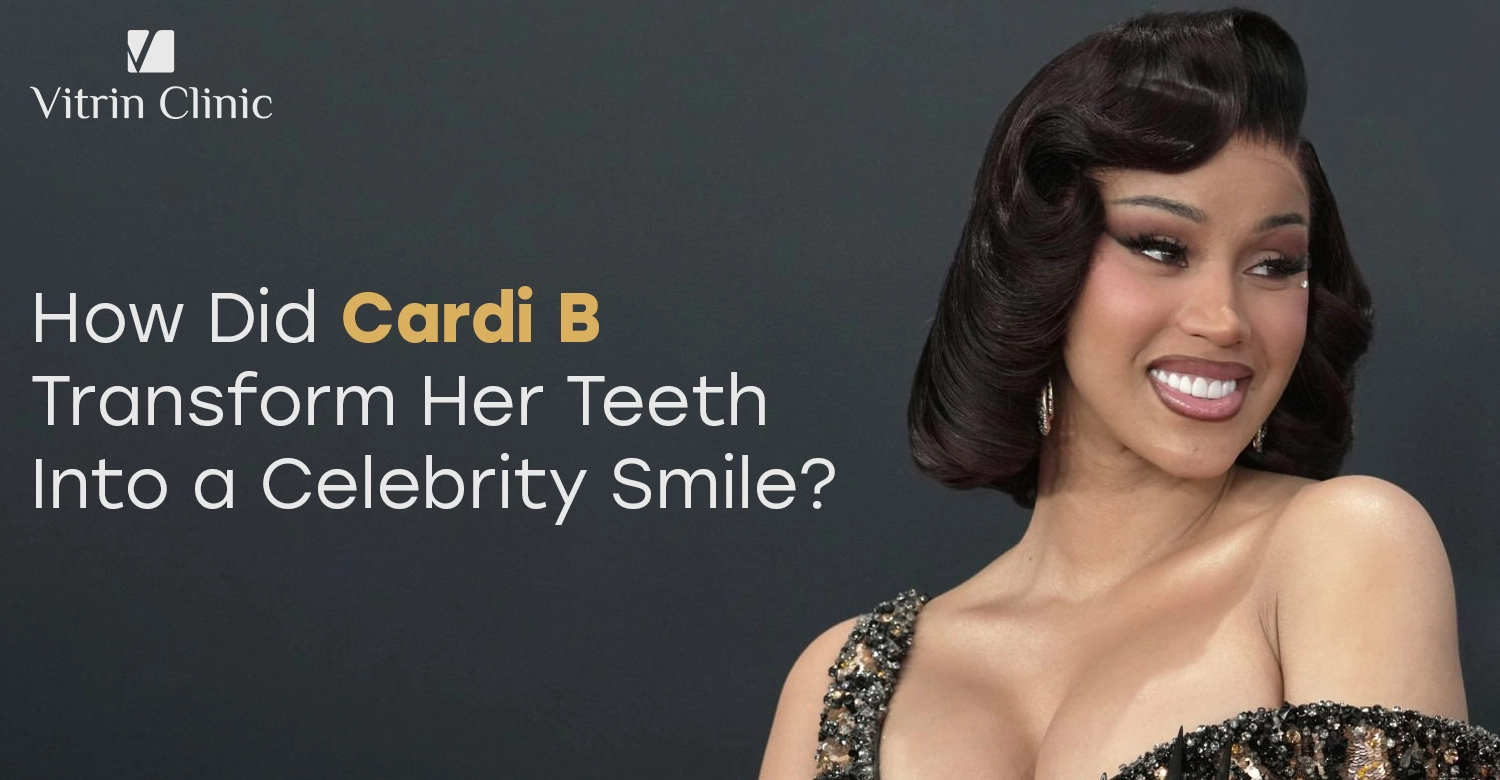 Cardi B Teeth