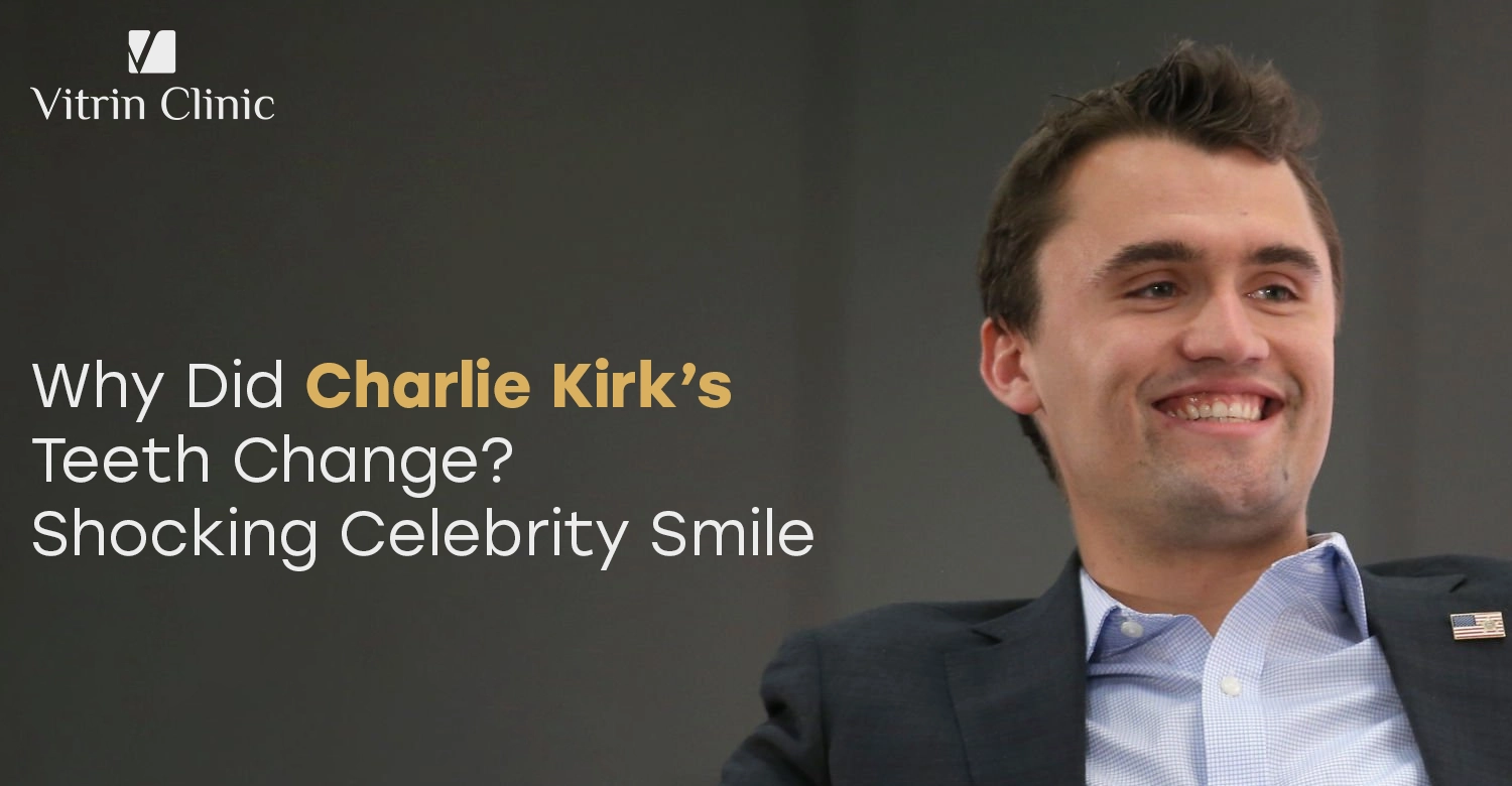 Charlie Kirk Teeth