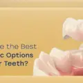 Top 5 Cosmetic Options to Cover Teeth for a Perfect Smile 2026?