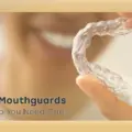 Top 5 Reasons Custom Mouthguards Are a Smart Choice in 2026