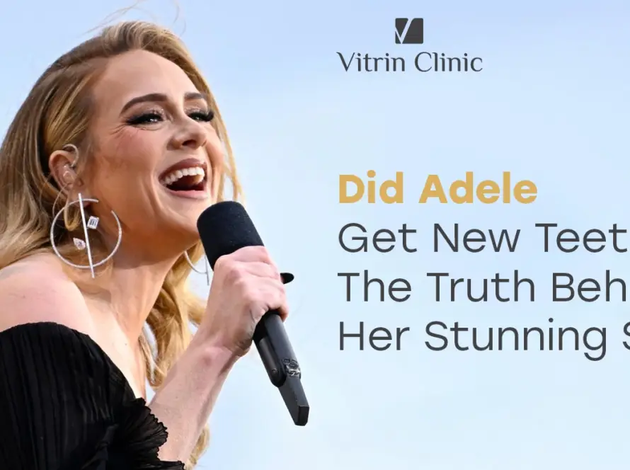 Adele smile: The Truth Behind Her Stunning 2026 teeth Transformation