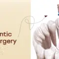 Could You Be Ignoring the Importance of Endodontic Microsurgery in 2026?
