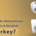 Is Endodontic Retreatment the 1 Powerful Solution for Lasting Dental Health in 2026?