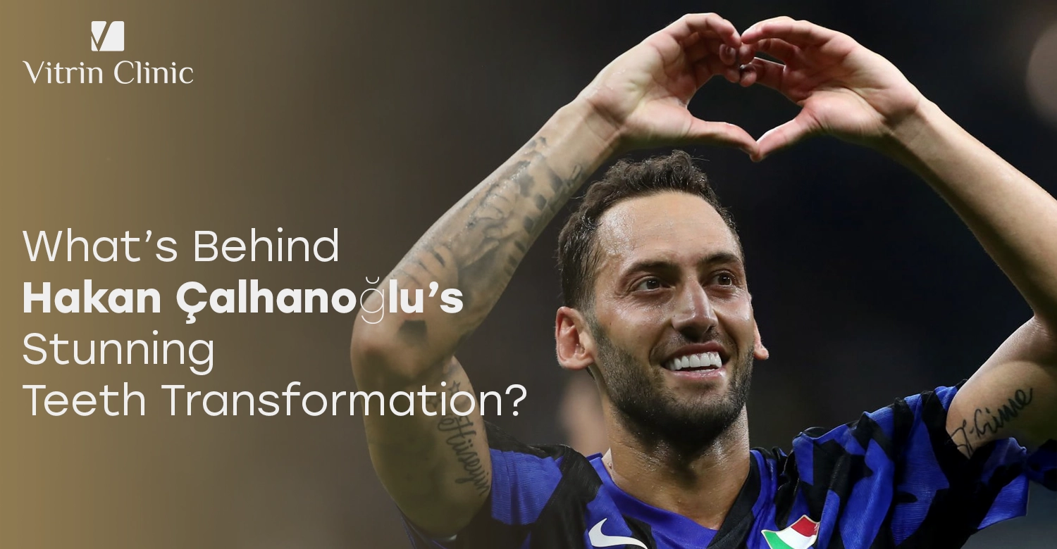 Hakan Çalhanoğlu Teeth