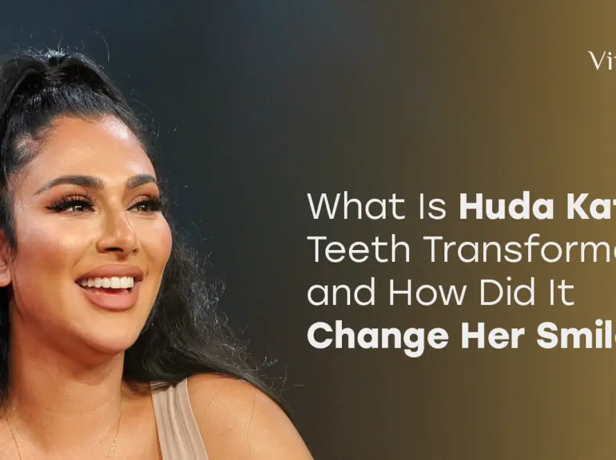 Huda Kattan Teeth Transformation