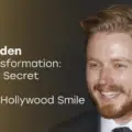 Who Is Jack Lowden and Why Are His Teeth Getting Attention?