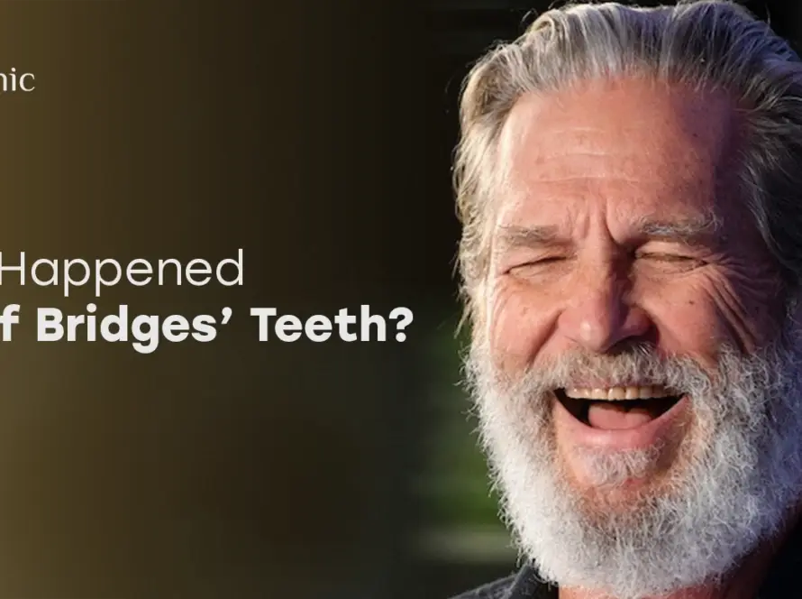 Jeff Bridges Teeth