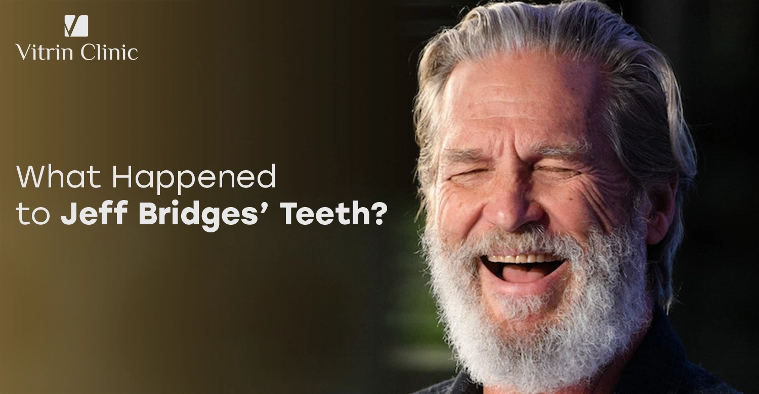 Jeff Bridges Teeth