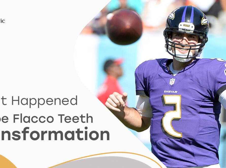 Joe Flacco Teeth