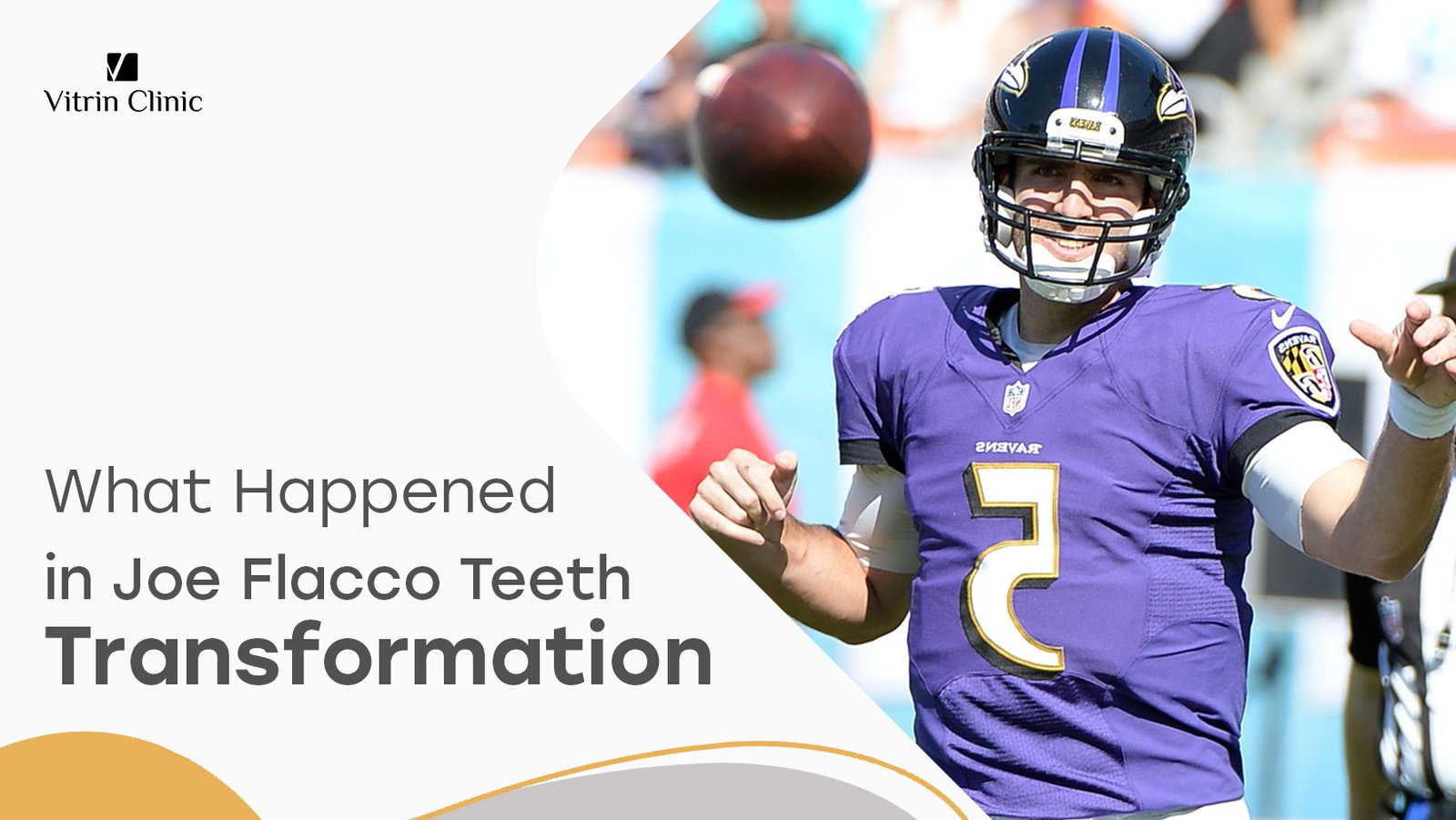 Joe Flacco Teeth