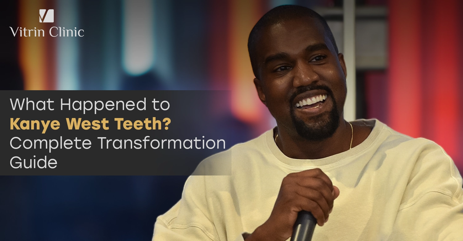 Kanye West Teeth