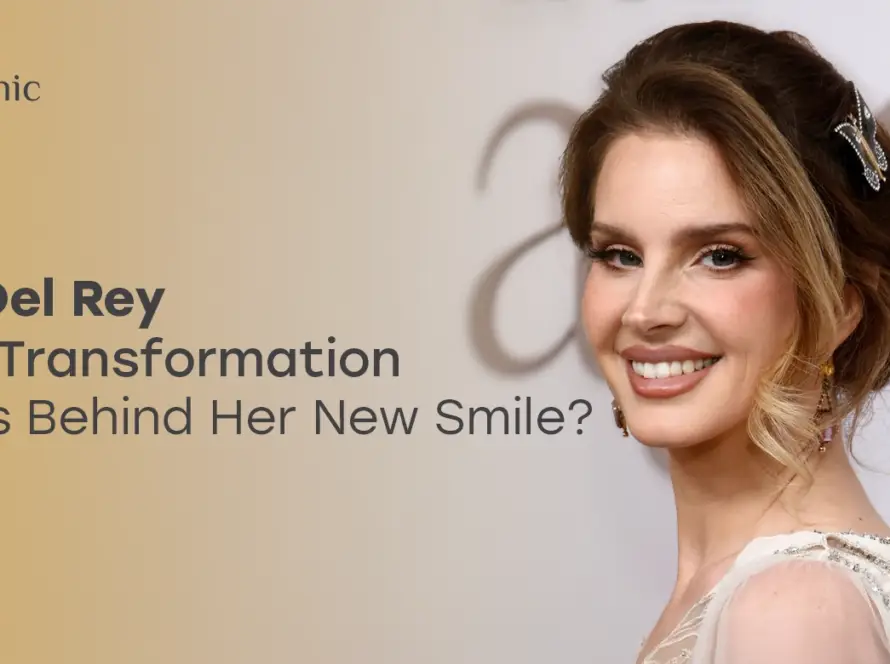 Lana Del Rey Teeth Transformation