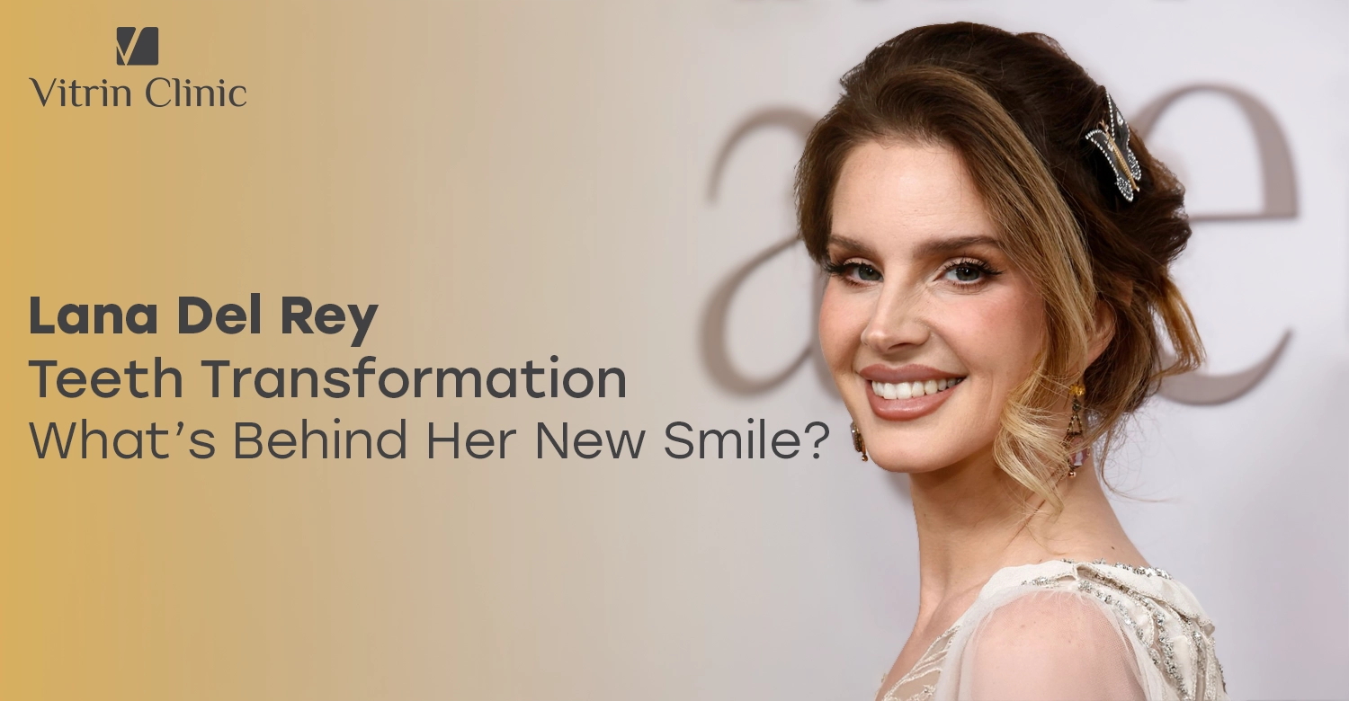 Lana Del Rey Teeth Transformation