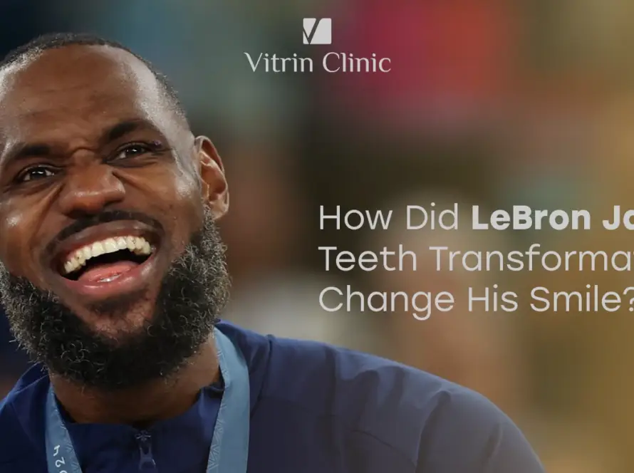 LeBron James Teeth Transformation