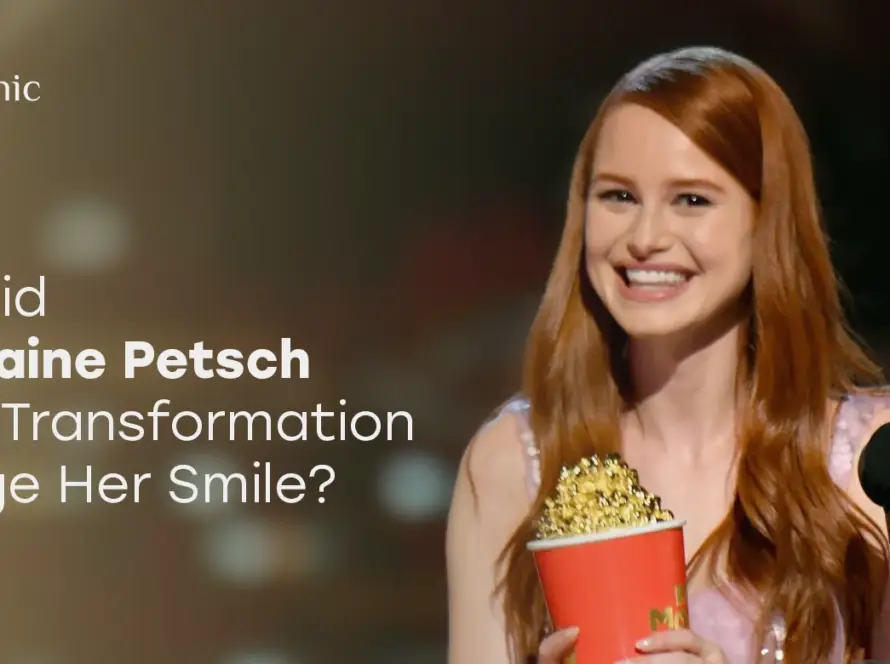 Madelaine Petsch Teeth Transformation