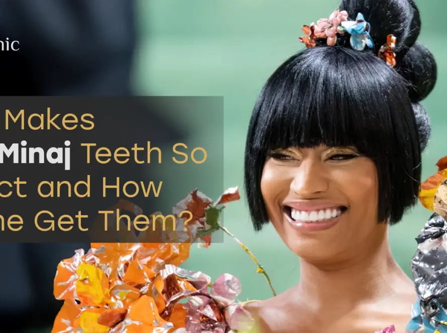 Nicki Minaj Teeth