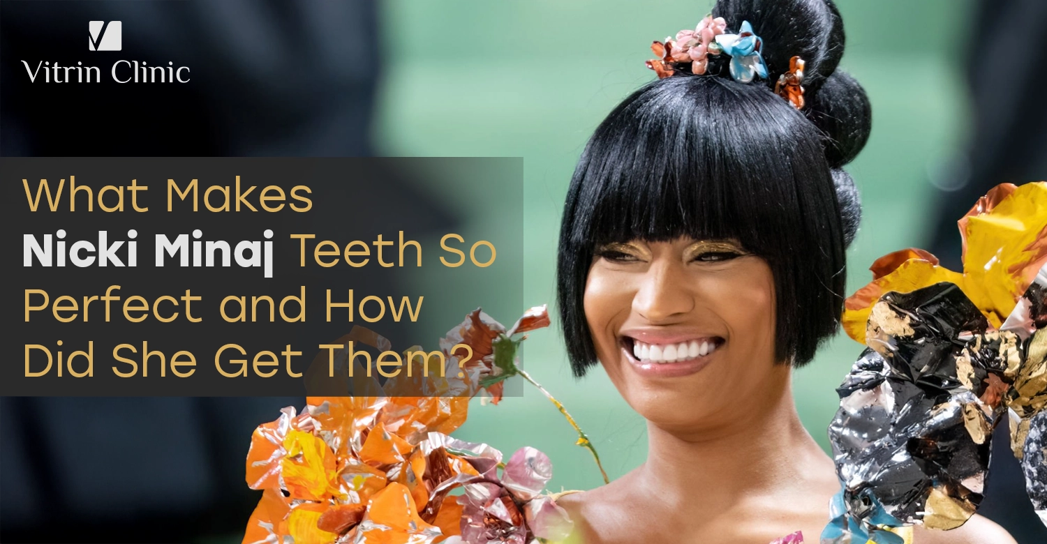 Nicki Minaj Teeth